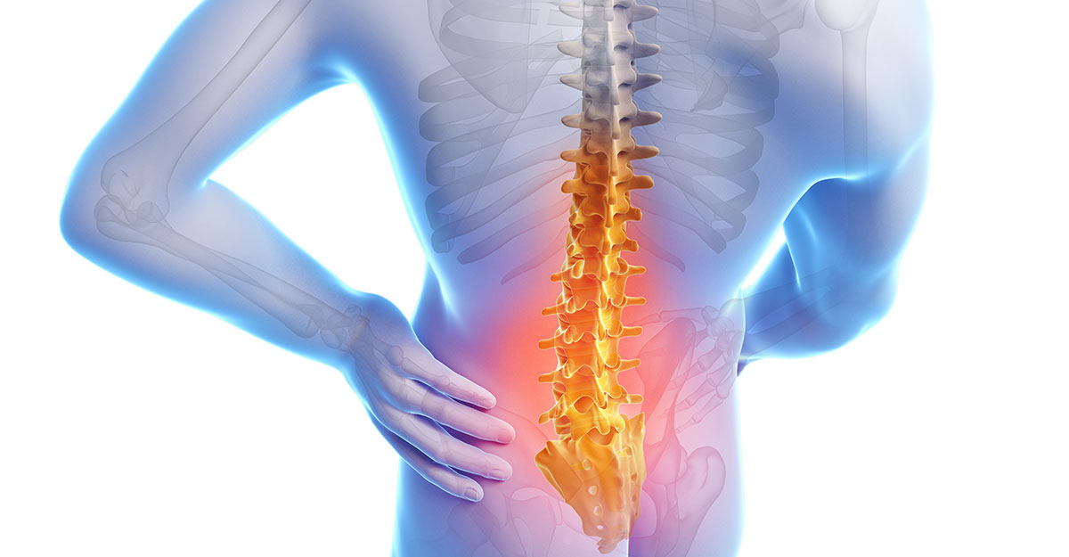 North County St. Louis, MO back pain treatment by Dr. Mark Holland