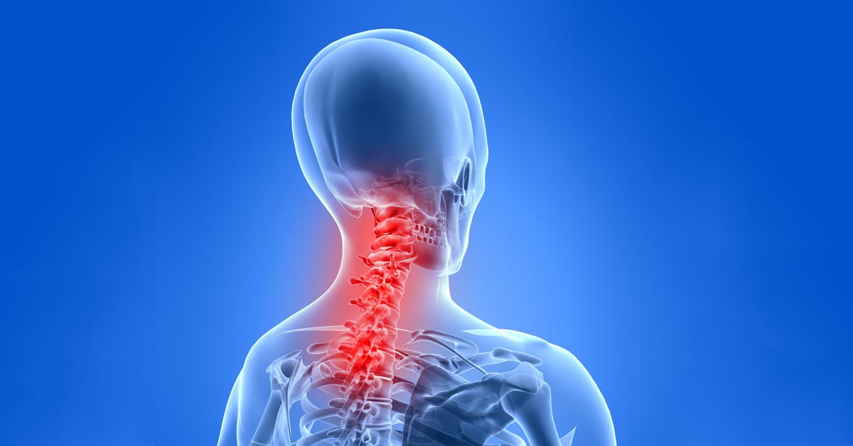 North County St. Louis, MO neck pain and headache treatment