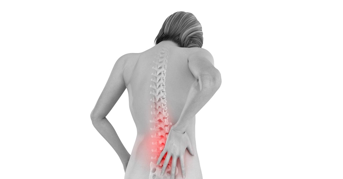 Spinal decompression therapy in North County St. Louis, MO