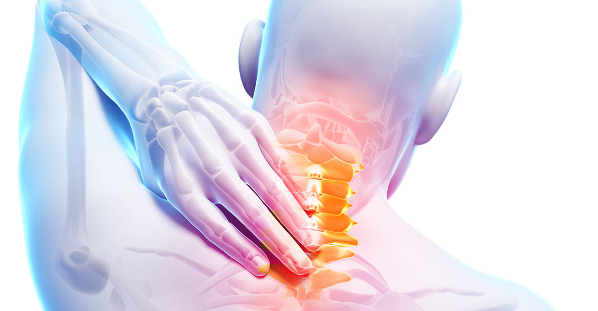 North County St. Louis, MO neck pain and headache treatment