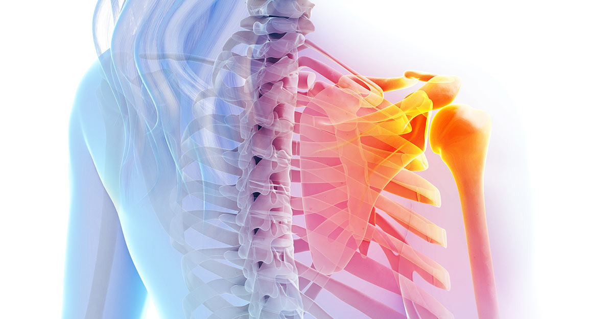 North County St. Louis, MO shoulder pain treatment and recovery